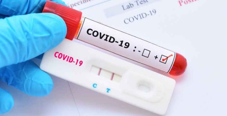 COVID-19: Three more die of virus in Jammu and Kashmir, toll 1941