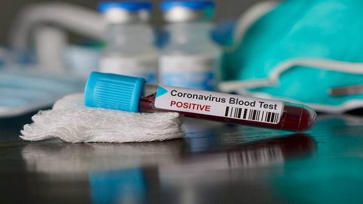 Uttrakhand Minister, wife among 22 members of family test positive for Covid-19