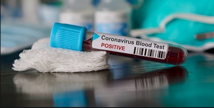 434 new COVID-19 cases in J&K; death toll nears 1,800 mark